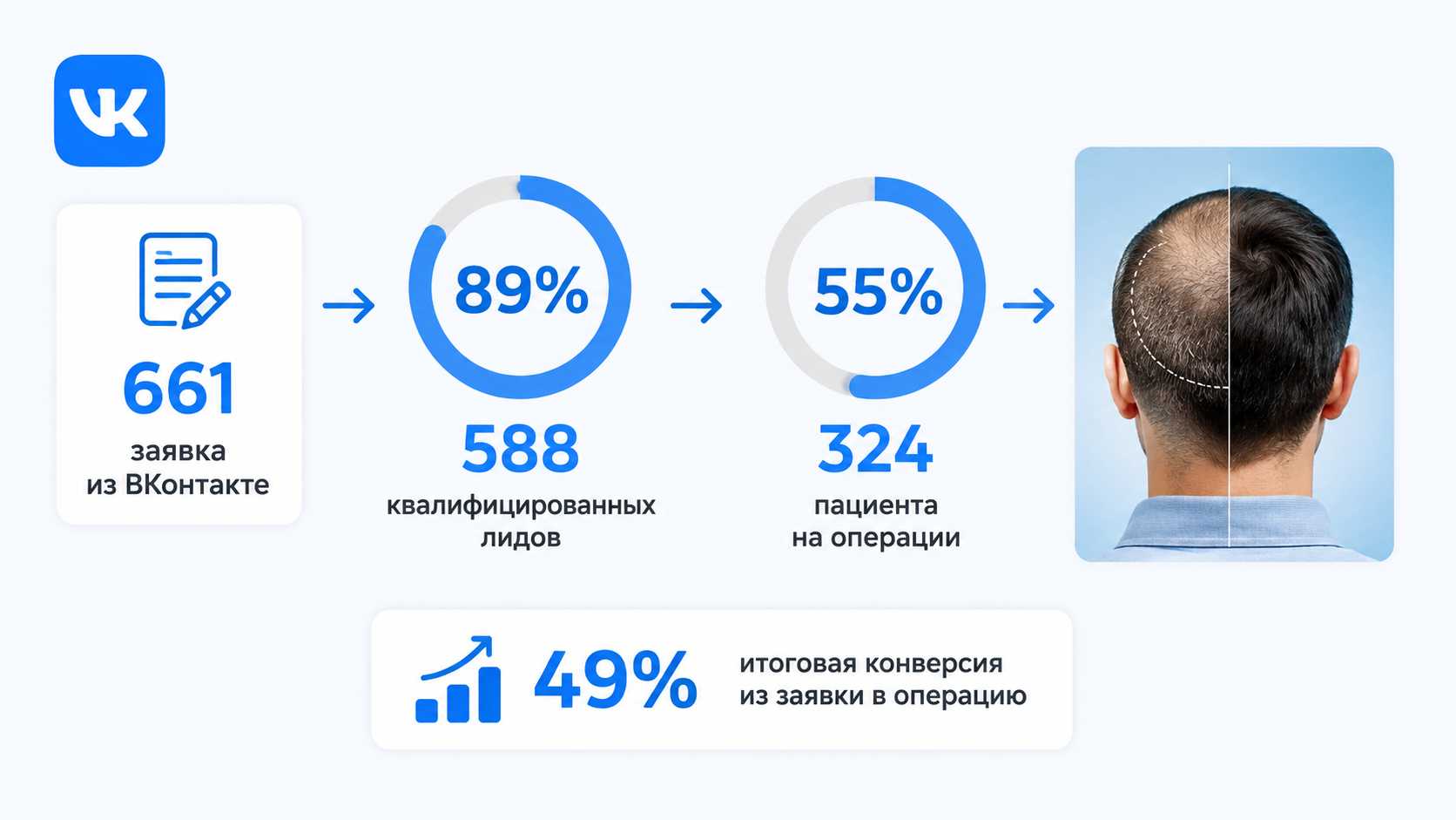 Результаты продвижения клиники пересадки волос во ВКонтакте